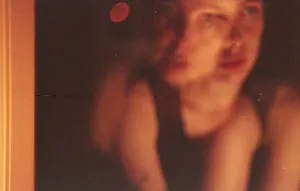 This Hurts artwork